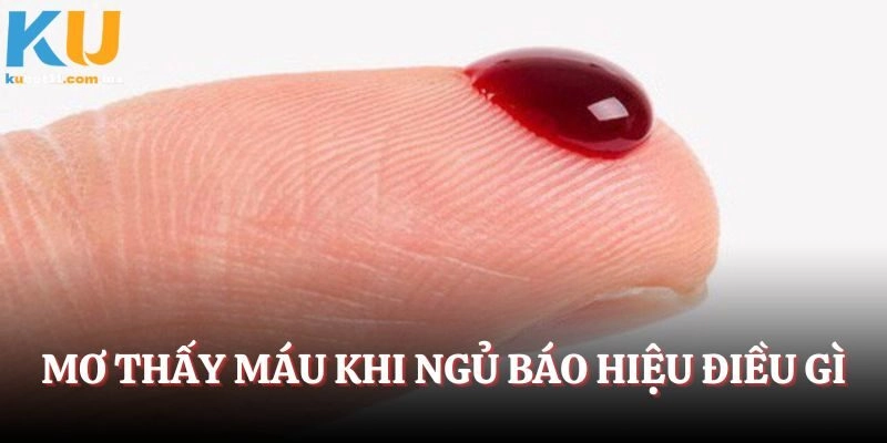 Mơ thấy máu khi ngủ báo hiệu điều gì